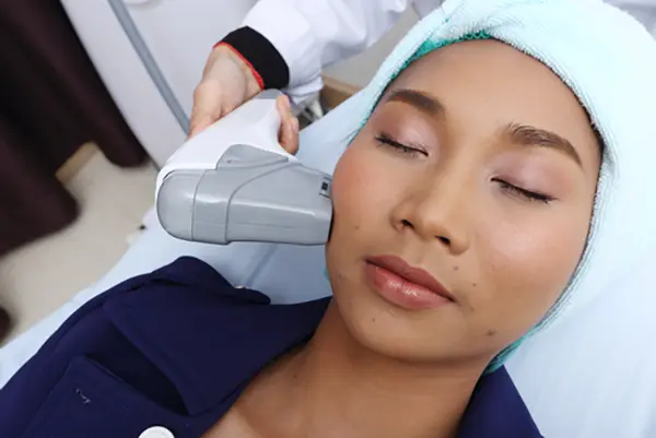 laser resurfacing