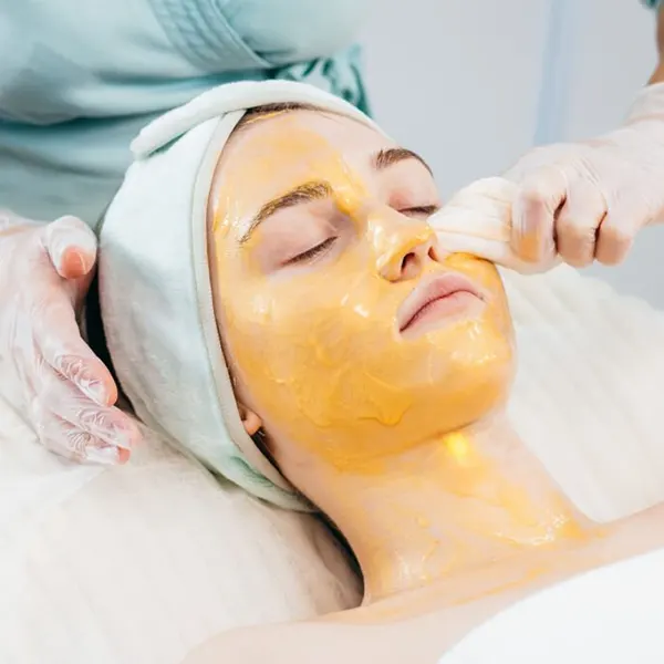 chemical peel